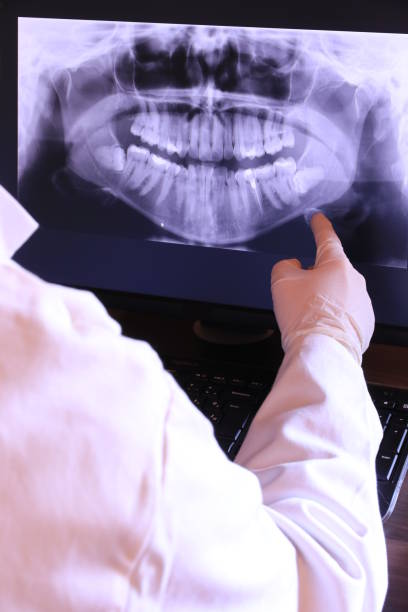 Best Emergency Dental Extractions in Windham, OH